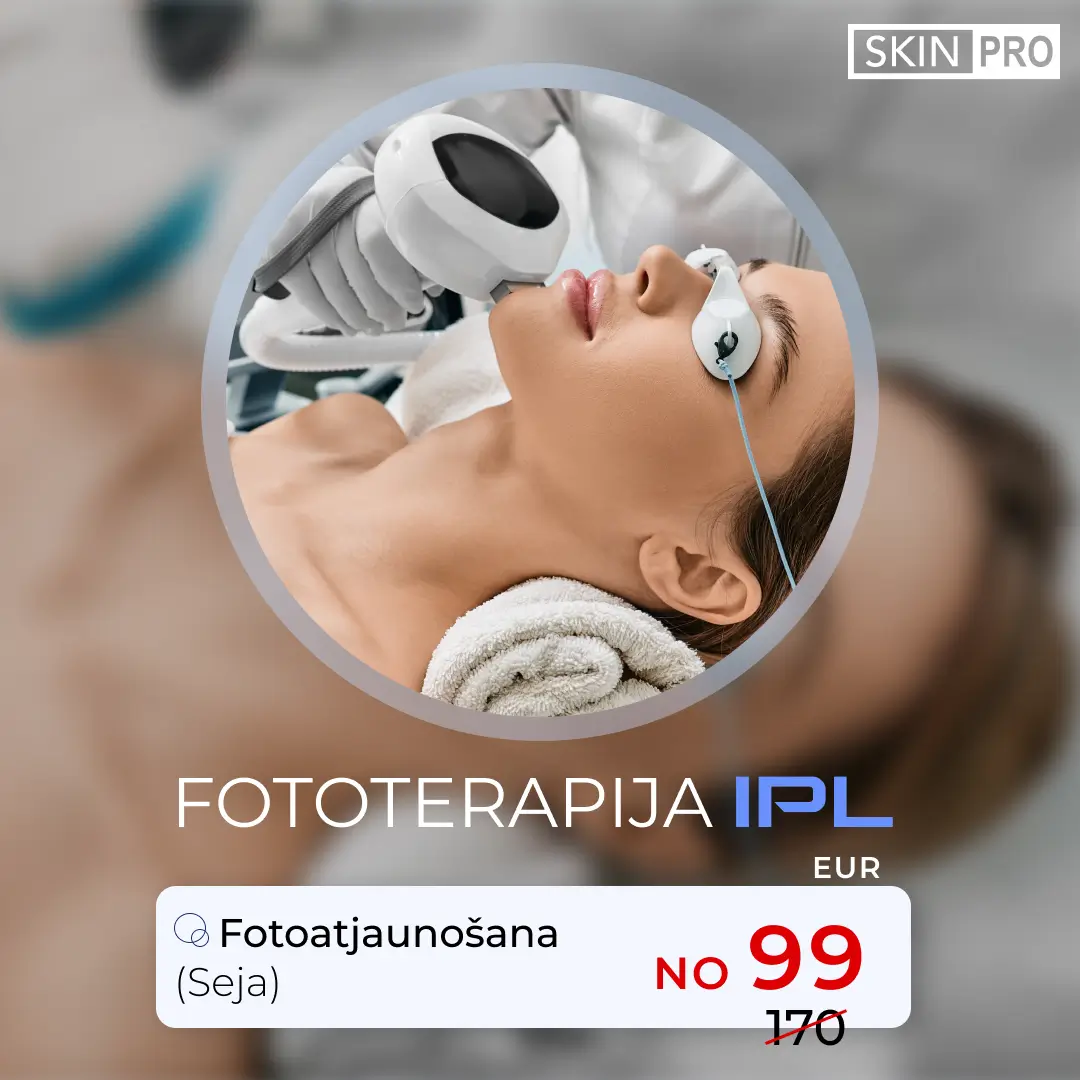 IPL Photorejuvenation Liepaja